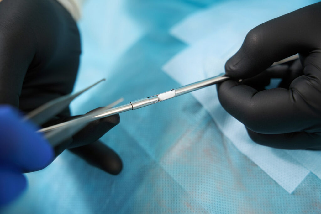 Hormone pellet insertion procedure at Peak Performance in Johnson City, Tennessee