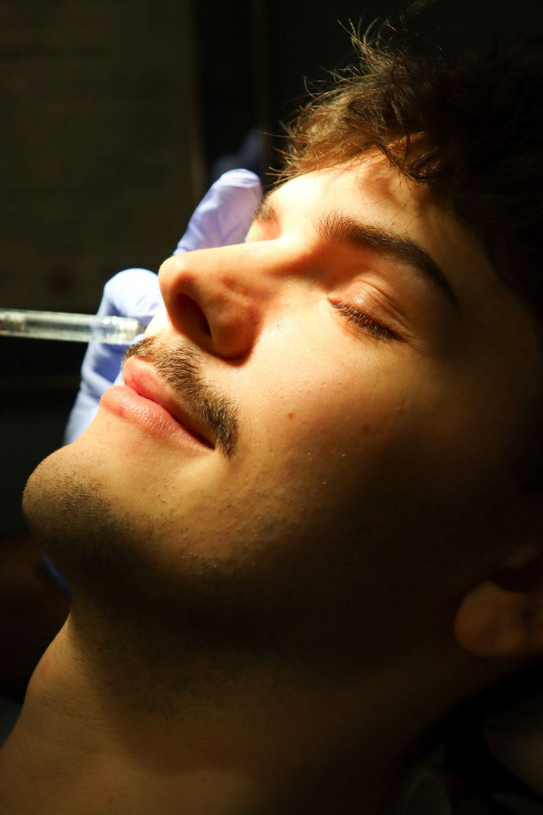 Close-up of a male patient receiving a cosmetic injection treatment in Johnson City, TN