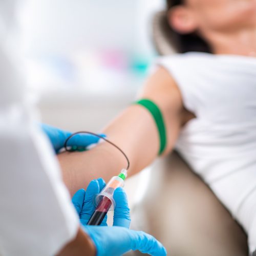 Blood draw to prepare platelet-rich plasma for PRP therapy at a medical wellness clinic in Johnson City, TN